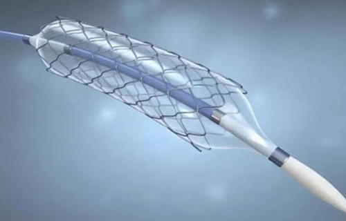 Comprehensive analysis and future prospects of drug-eluting stents market